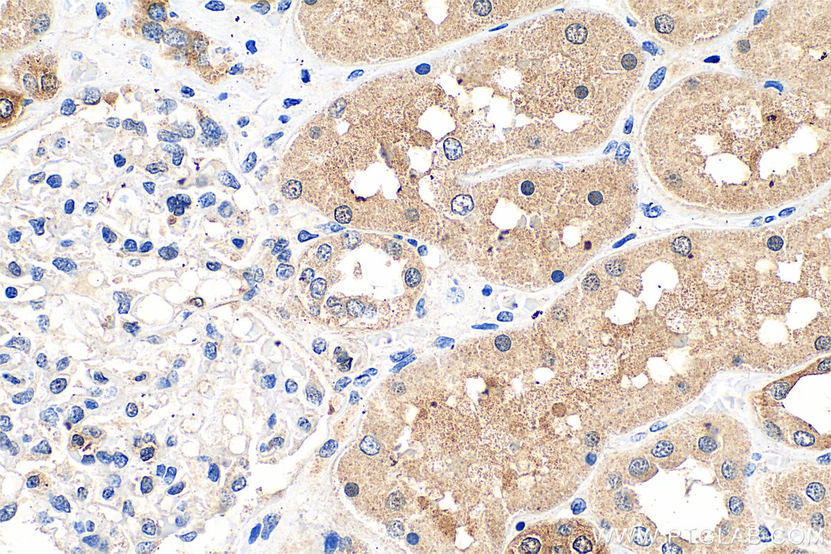 Immunohistochemistry (IHC) staining of human kidney tissue using KANK2 Polyclonal antibody (21733-1-AP)