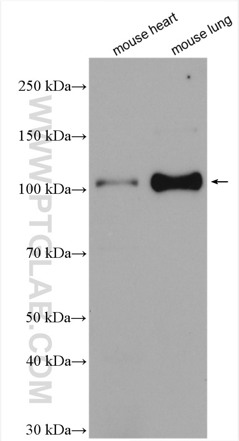Western Blot (WB) analysis of various lysates using KANK2 Polyclonal antibody (21733-1-AP)