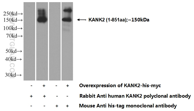 Western Blot (WB) analysis of Transfected HEK-293 cells using KANK2 Polyclonal antibody (21733-1-AP)