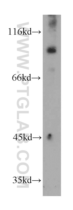 Western Blot (WB) analysis of mouse kidney tissue using KANK2 Polyclonal antibody (21733-1-AP)