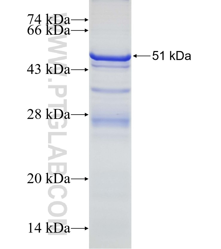 KANK2 fusion protein Ag16416 SDS-PAGE