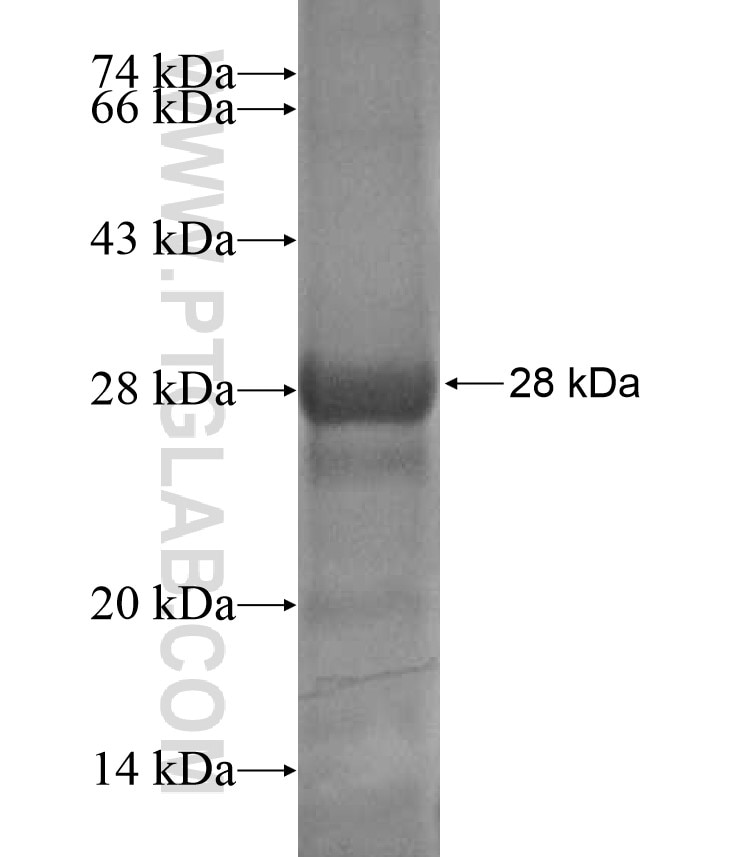 KANK2 fusion protein Ag17284 SDS-PAGE