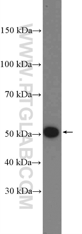 Western Blot (WB) analysis of mouse heart tissue using KANSL2 Polyclonal antibody (27261-1-AP)