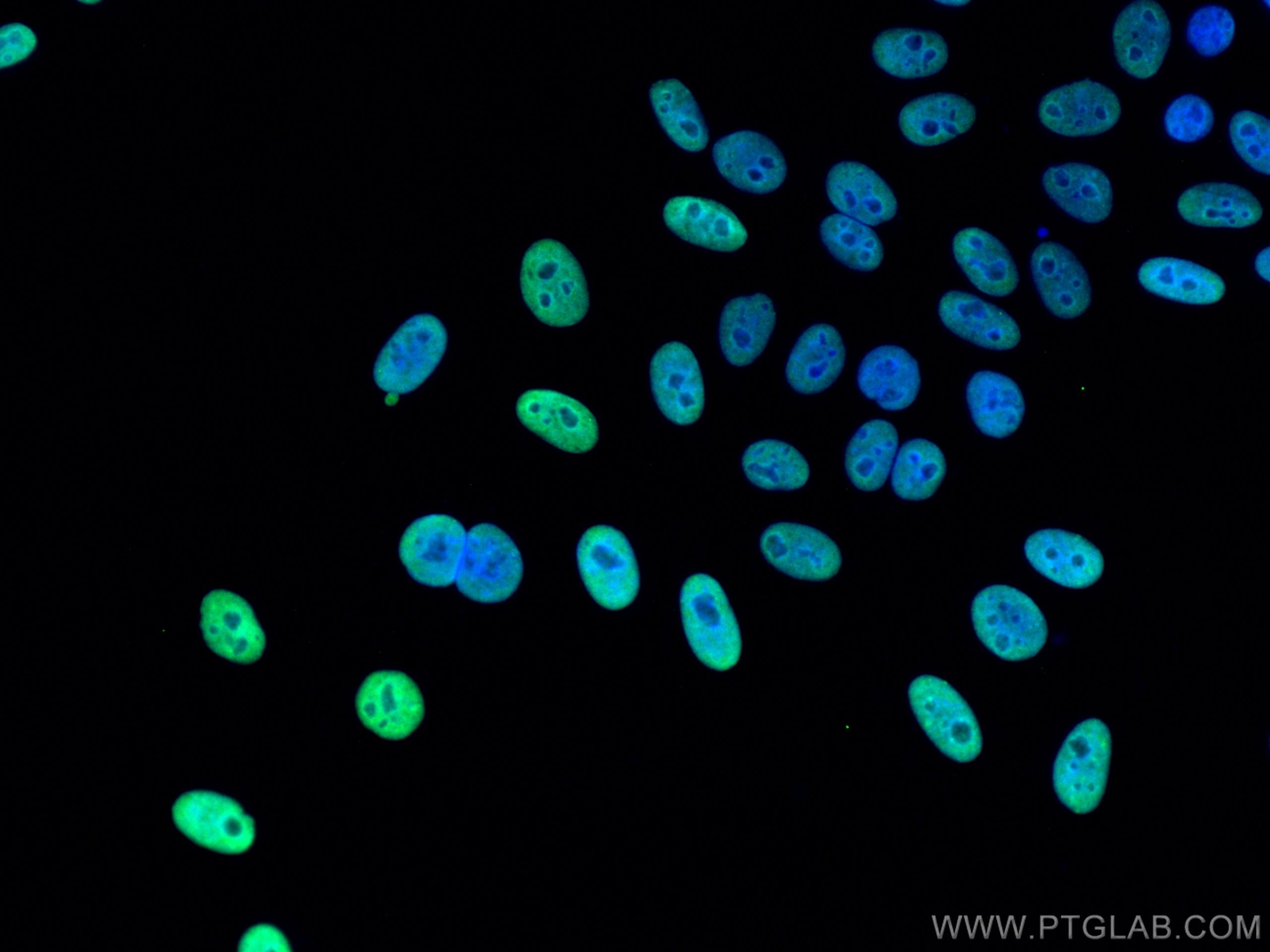 Immunofluorescence (IF) / fluorescent staining of HepG2 cells using KAP1 Monoclonal antibody (66630-1-Ig)