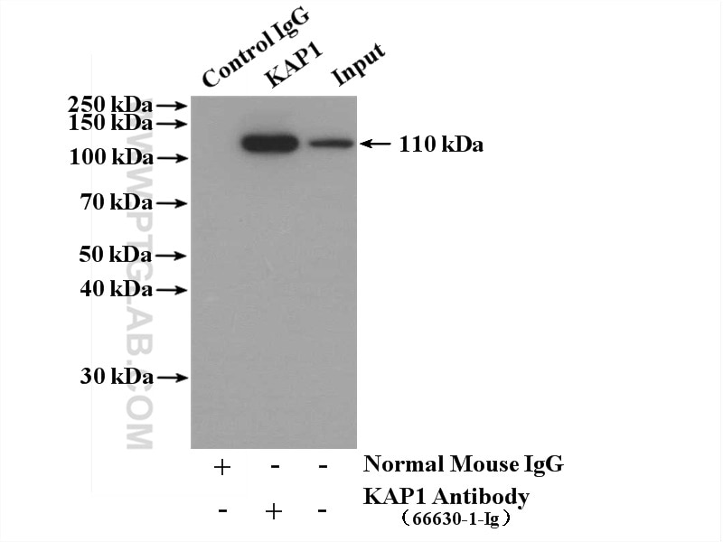 Immunoprecipitation (IP) experiment of HeLa cells using KAP1 Monoclonal antibody (66630-1-Ig)