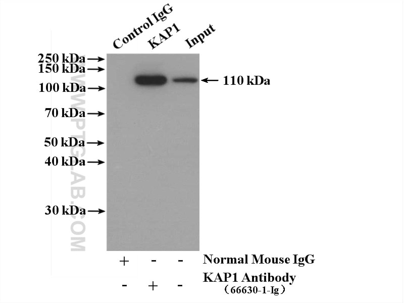 IP experiment of HeLa using 66630-1-Ig