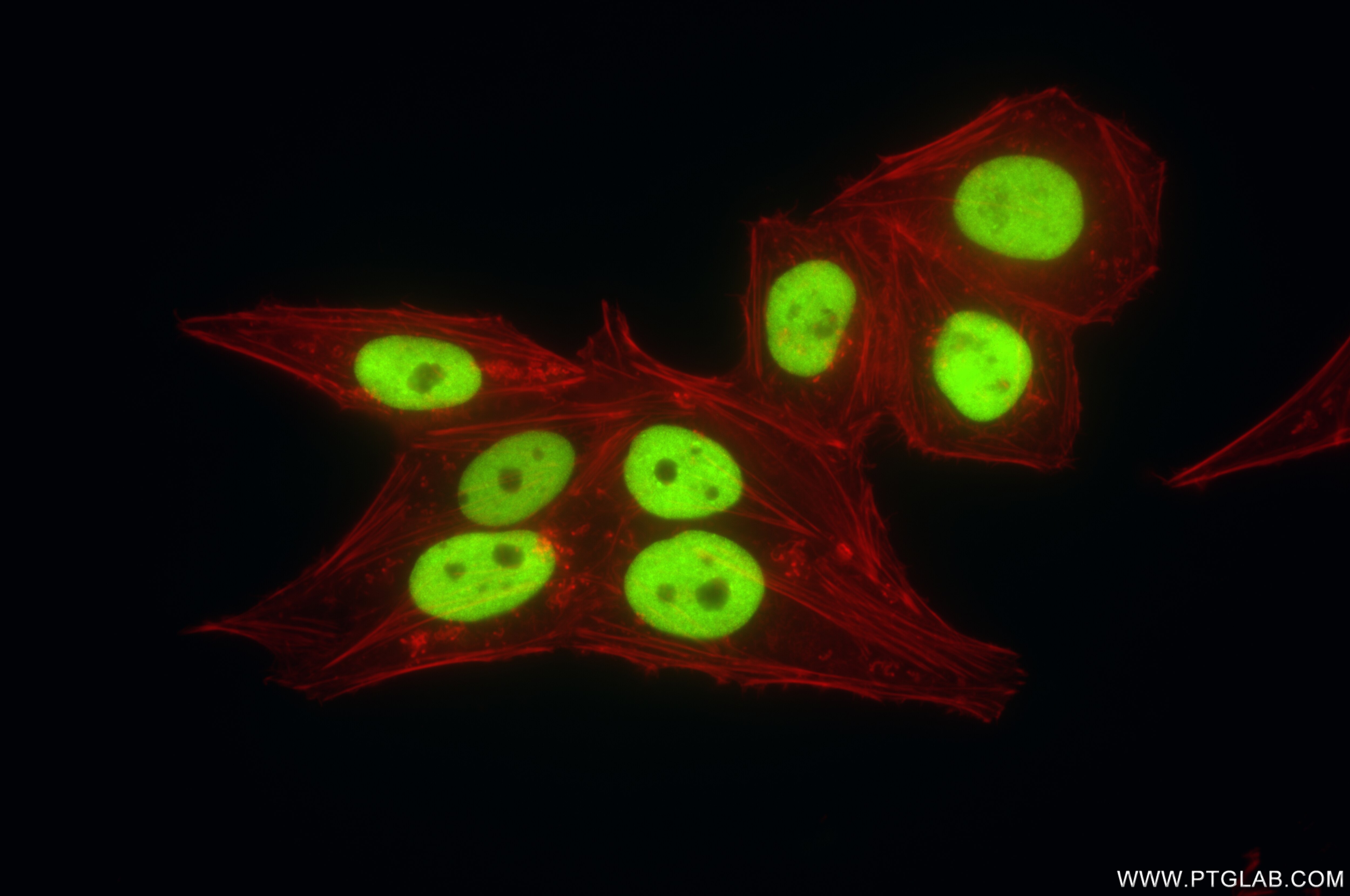 Immunofluorescence (IF) / fluorescent staining of HepG2 cells using KAP1 Recombinant antibody (85693-4-RR)