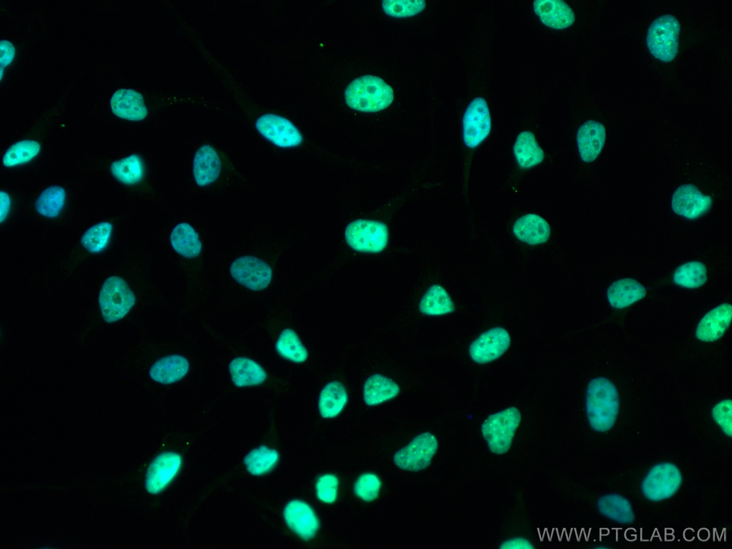 Immunofluorescence (IF) / fluorescent staining of HeLa cells using CoraLite® Plus 488-conjugated KAP1 Polyclonal anti (CL488-15202)