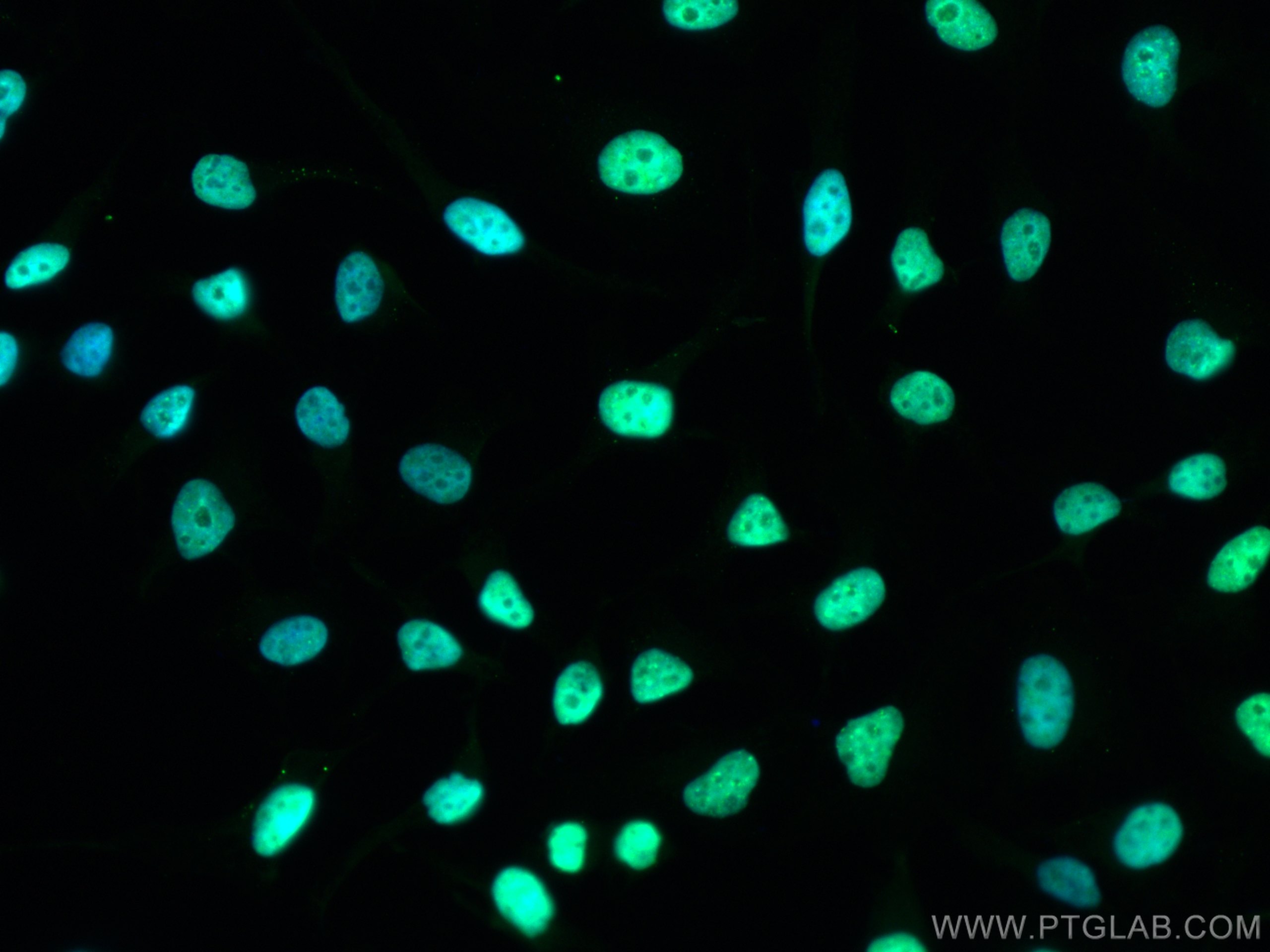 Immunofluorescence (IF) / fluorescent staining of HeLa cells using CoraLite® Plus 488-conjugated KAP1 Polyclonal anti (CL488-15202)