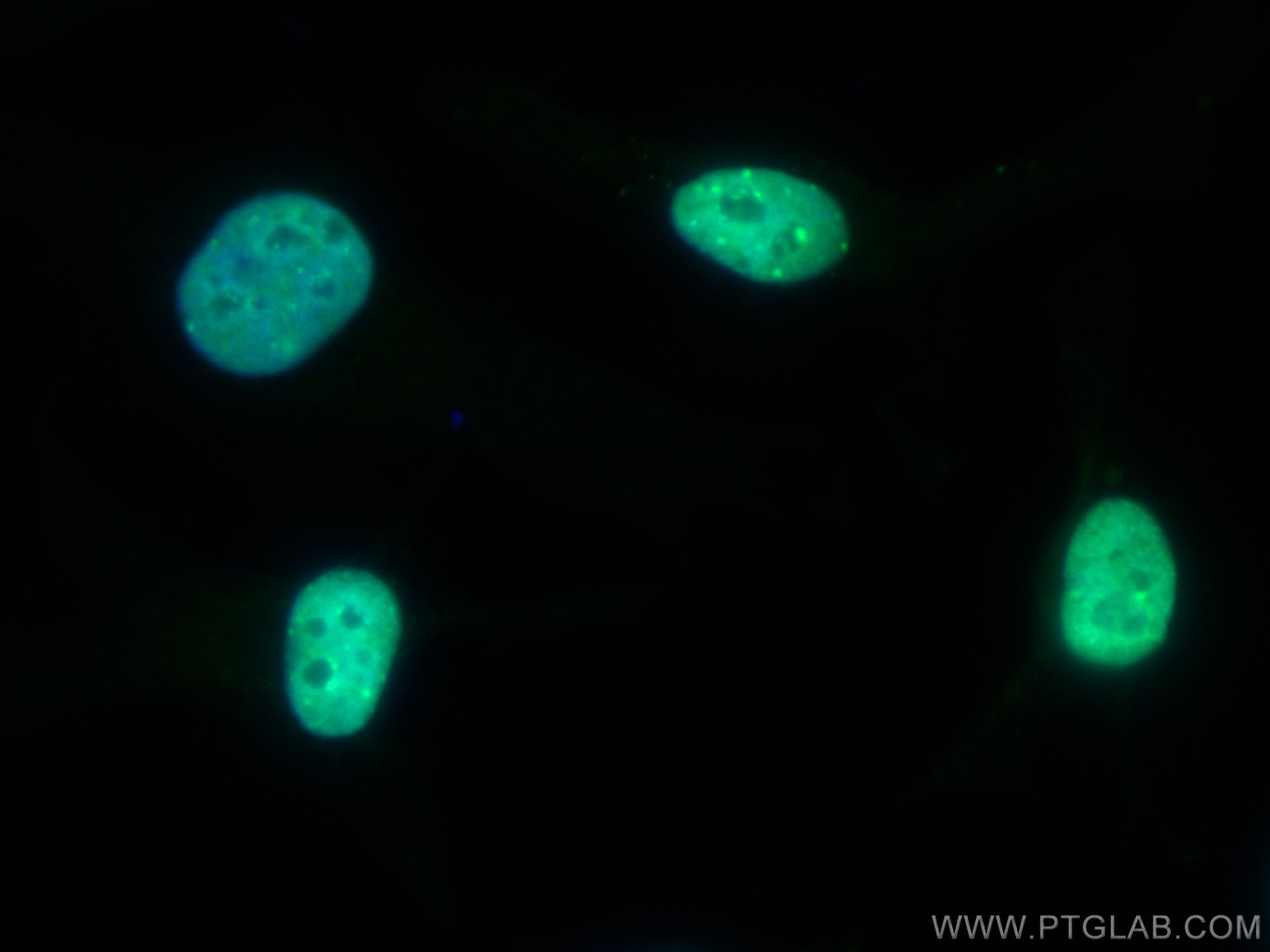 Immunofluorescence (IF) / fluorescent staining of HeLa cells using CoraLite® Plus 488-conjugated KAP1 Polyclonal anti (CL488-15202)