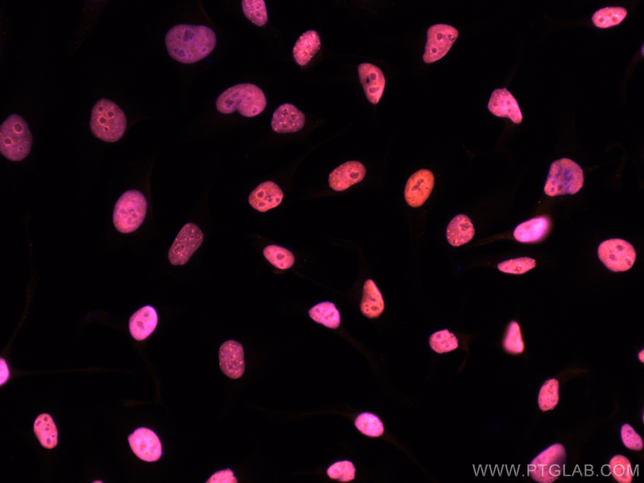 Immunofluorescence (IF) / fluorescent staining of HeLa cells using CoraLite®555-conjugated KAP1 Polyclonal antibody (CL555-15202)