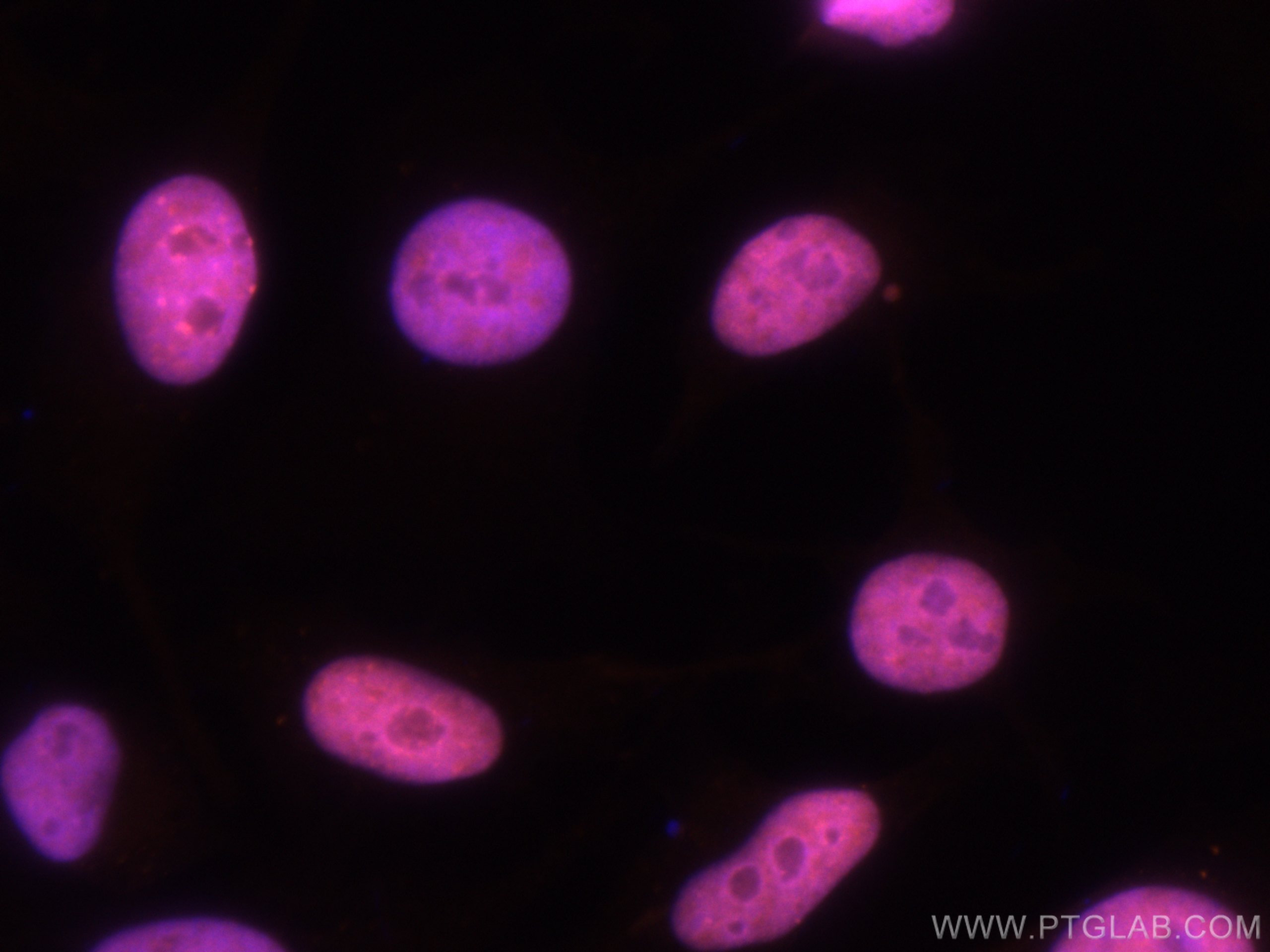 Immunofluorescence (IF) / fluorescent staining of HeLa cells using CoraLite®555-conjugated KAP1 Polyclonal antibody (CL555-15202)