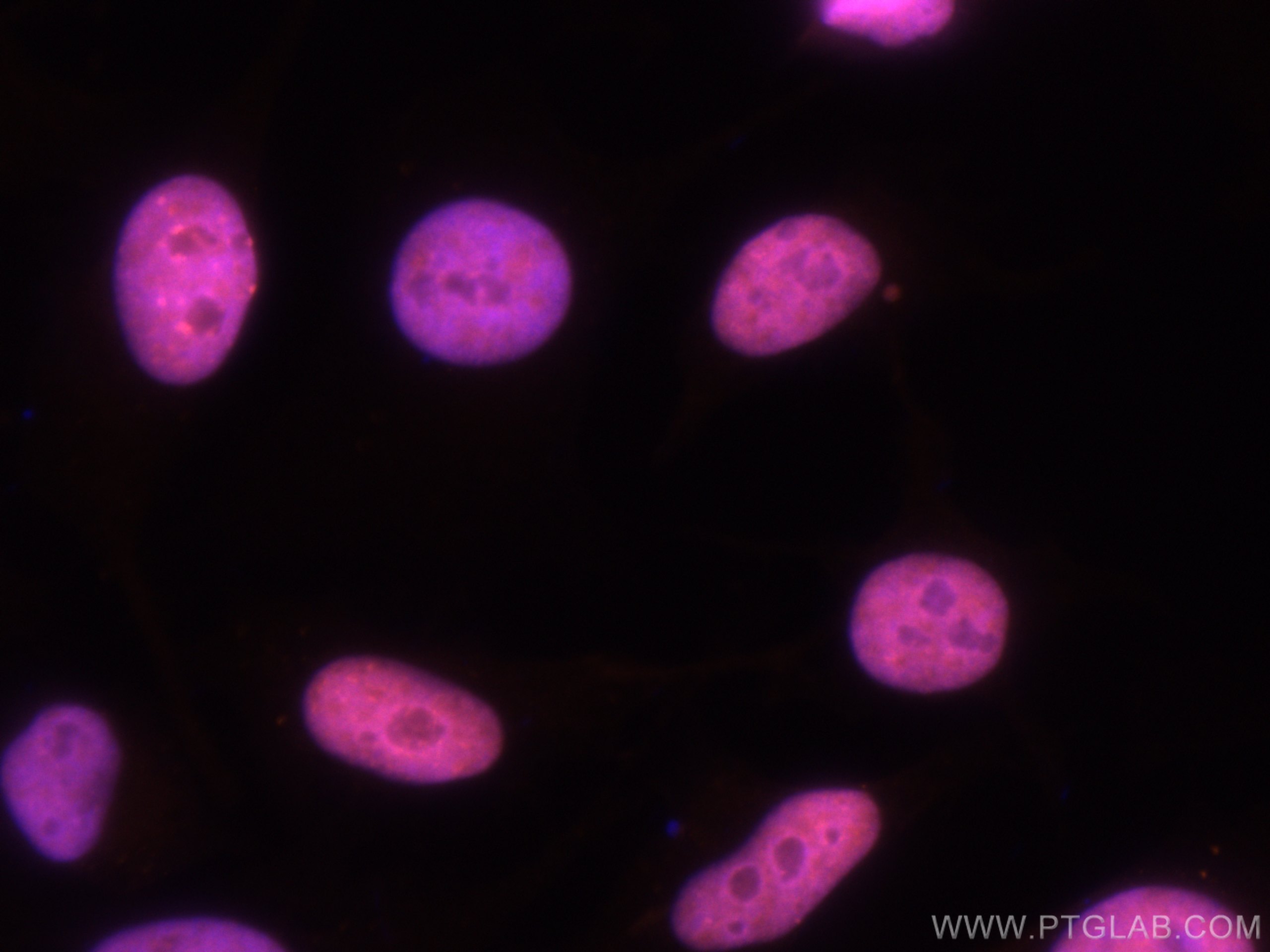 IF Staining of HeLa using CL555-15202