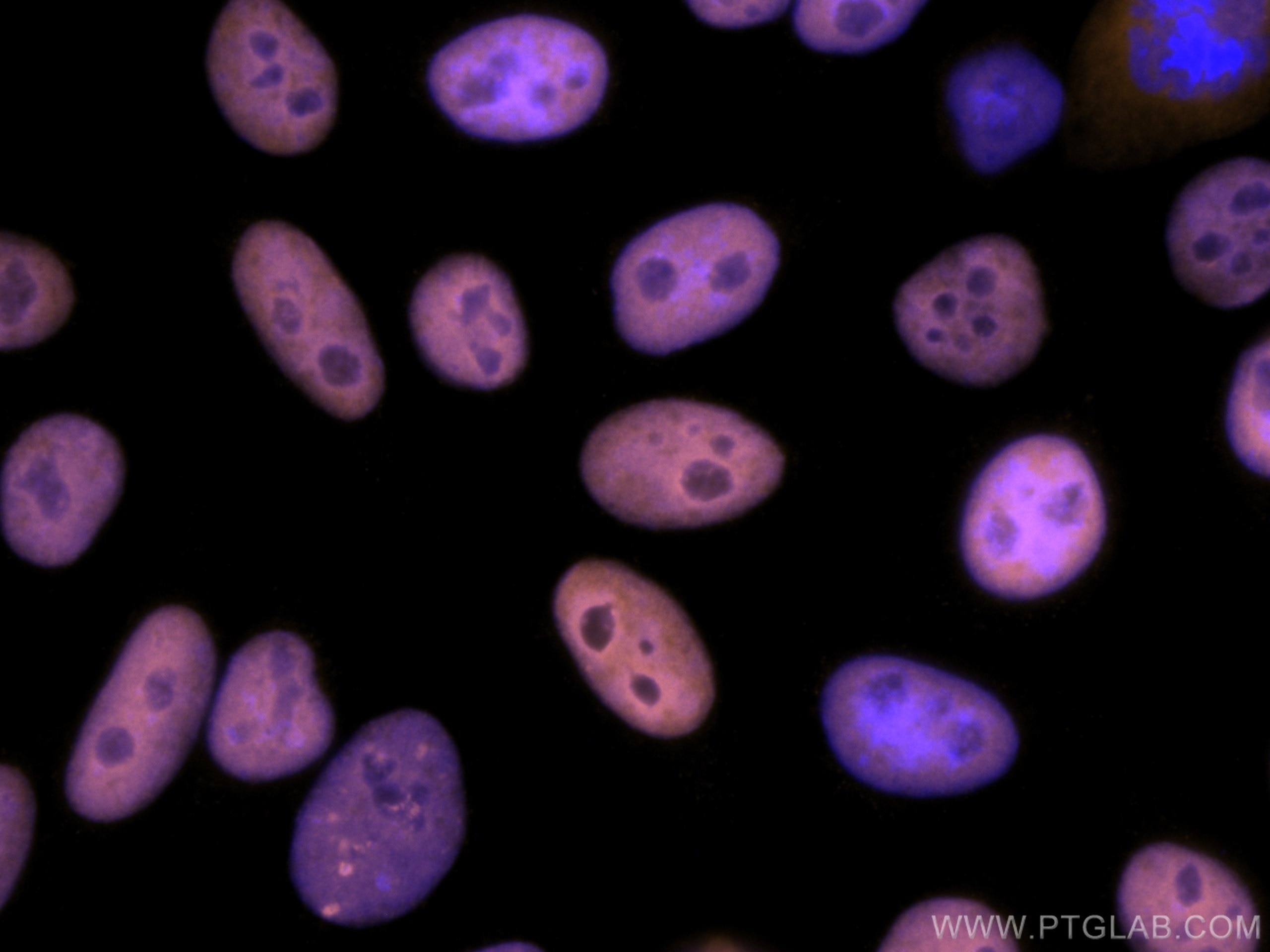 Immunofluorescence (IF) / fluorescent staining of HepG2 cells using CoraLite®555-conjugated KAP1 Monoclonal antibody (CL555-66630)