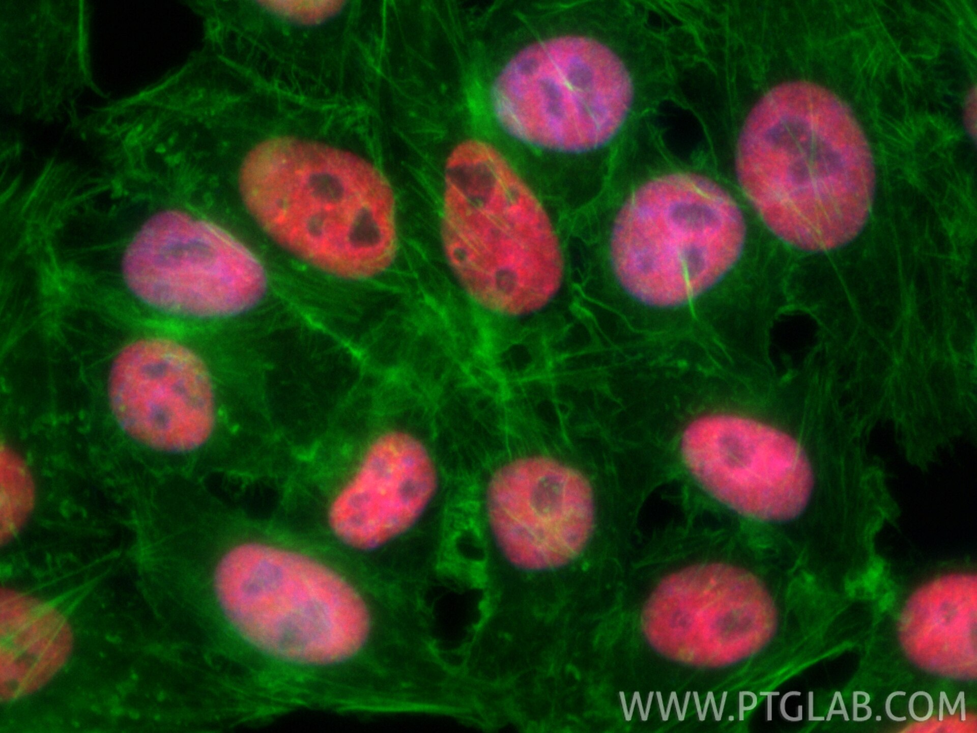 Immunofluorescent analysis of (4% PFA) fixed HepG2 cells using CoraLite®594 KAP1 antibody (CL594-85693-4, Clone: 243043D10 ) at dilution of 1:200, CL488-Phalloidin (green). Immunofluorescence (IF) / fluorescent staining of HepG2 cells using CoraLite®594-conjugated KAP1 Recombinant monoclona (CL594-85693-4)