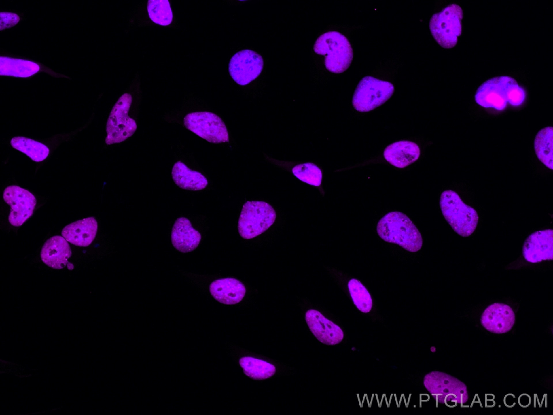 Immunofluorescence (IF) / fluorescent staining of HeLa cells using CoraLite® Plus 647-conjugated KAP1 Polyclonal anti (CL647-15202)