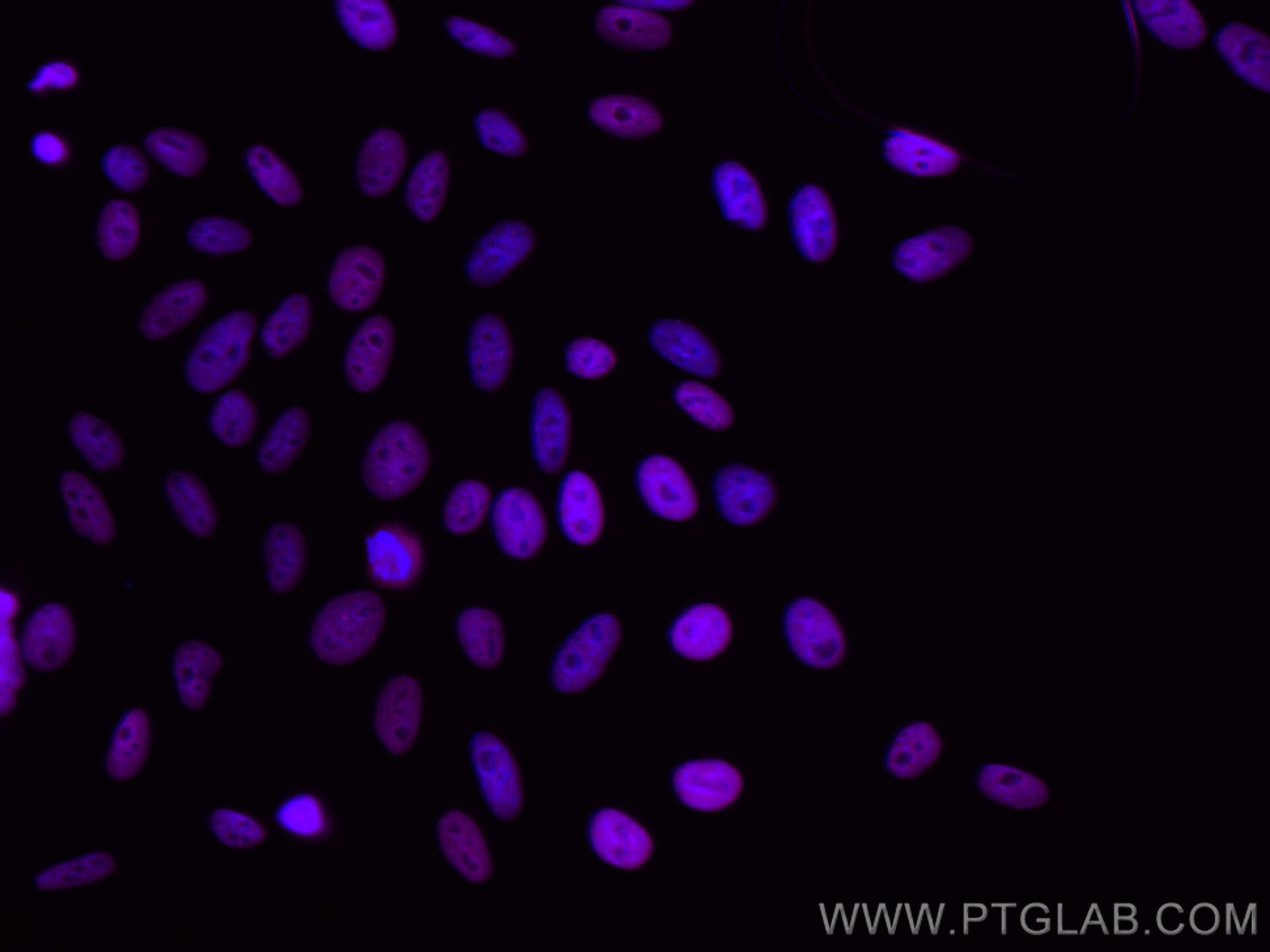 Immunofluorescence (IF) / fluorescent staining of HepG2 cells using CoraLite® Plus 647-conjugated KAP1 Monoclonal anti (CL647-66630)