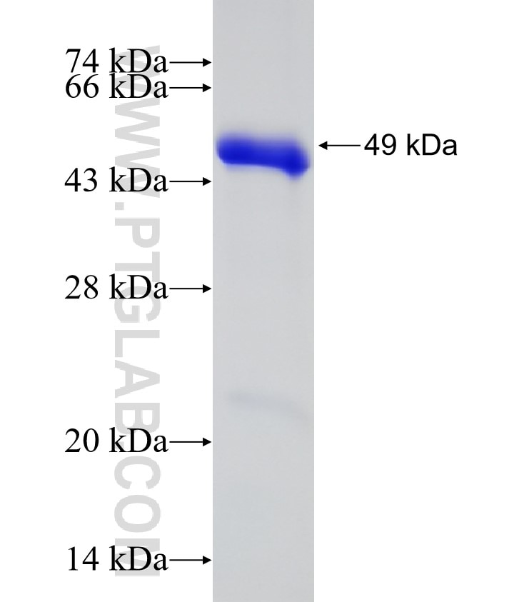 KAP1 fusion protein Ag7519 SDS-PAGE