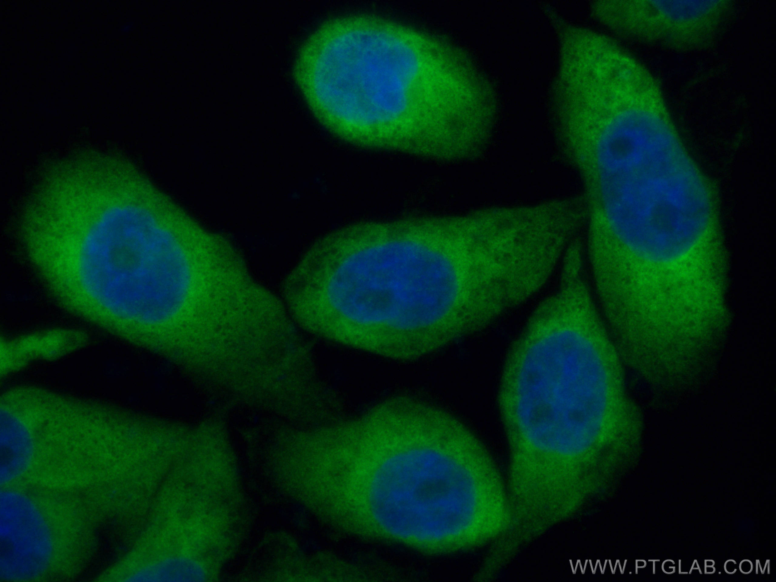 Immunofluorescence (IF) / fluorescent staining of A431 cells using KARS Polyclonal antibody (14951-1-AP)
