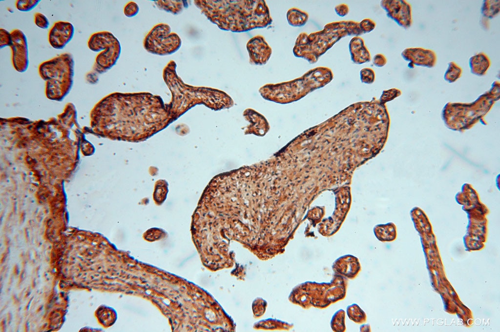Immunohistochemistry (IHC) staining of human placenta tissue using KARS Polyclonal antibody (14951-1-AP)