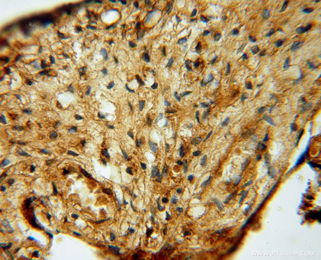 Immunohistochemistry (IHC) staining of human placenta tissue using KARS Polyclonal antibody (14951-1-AP)