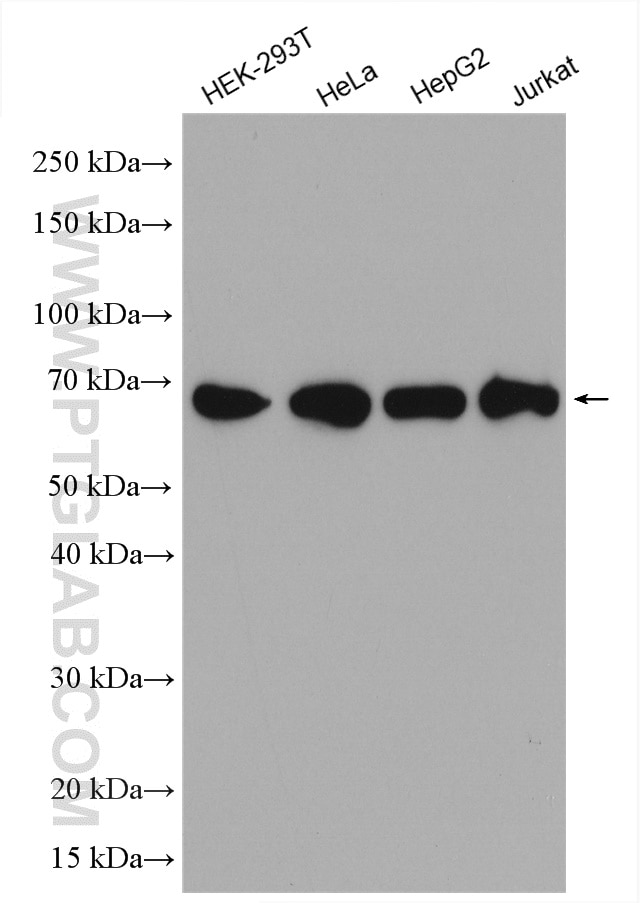 Western Blot (WB) analysis of various lysates using KARS Polyclonal antibody (14951-1-AP)