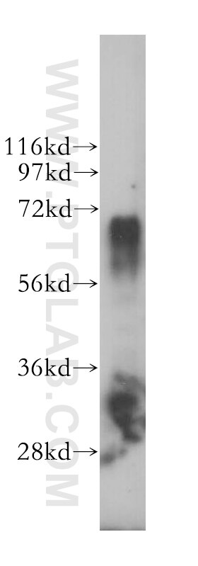 Western Blot (WB) analysis of Jurkat cells using KARS Polyclonal antibody (14951-1-AP)