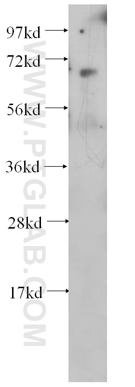 Western Blot (WB) analysis of human colon tissue using KARS Polyclonal antibody (14951-1-AP)