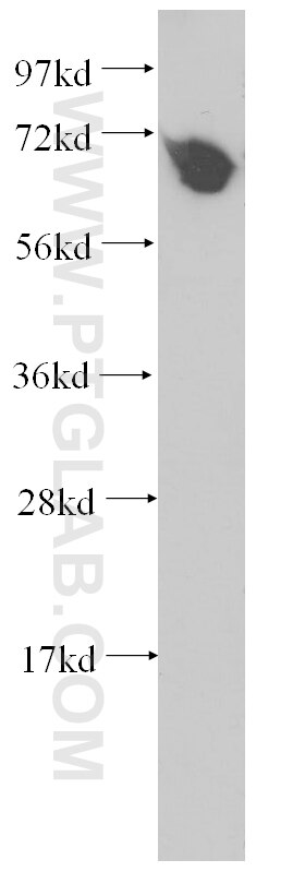 KARS Polyclonal antibody