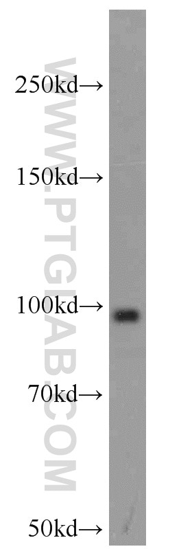 Western Blot (WB) analysis of MCF-7 cells using KAT2A/GCN5 Polyclonal antibody (14983-1-AP)