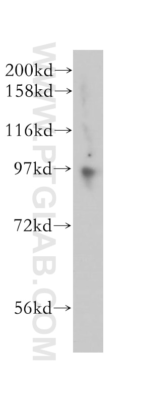 Western Blot (WB) analysis of mouse ovary tissue using KAT2A/GCN5 Polyclonal antibody (14983-1-AP)