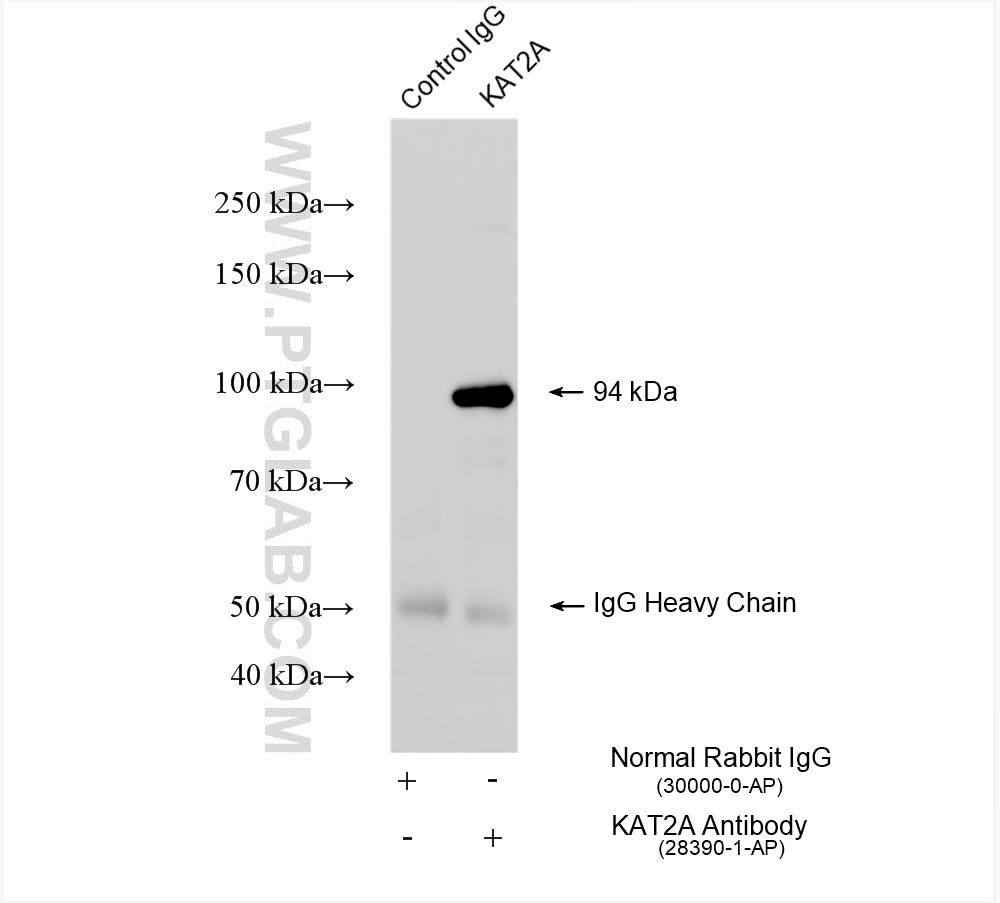 KAT2A/GCN5