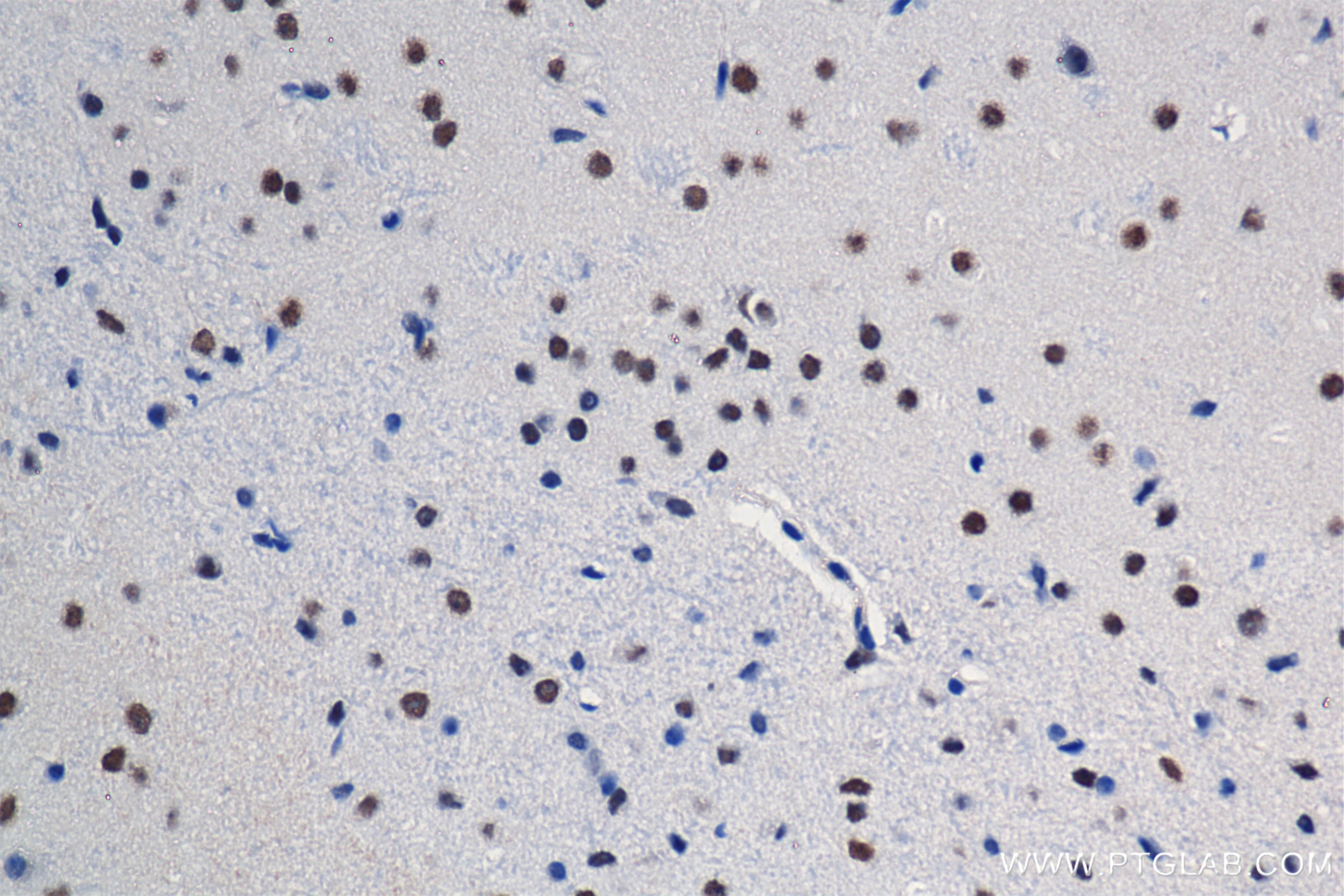 Immunohistochemistry (IHC) staining of mouse brain tissue using KAT2A/GCN5 Recombinant antibody (84669-2-RR)
