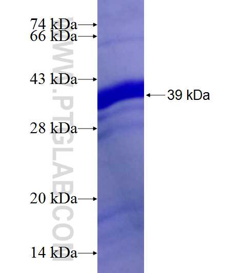 KAT2A fusion protein Ag6940 SDS-PAGE