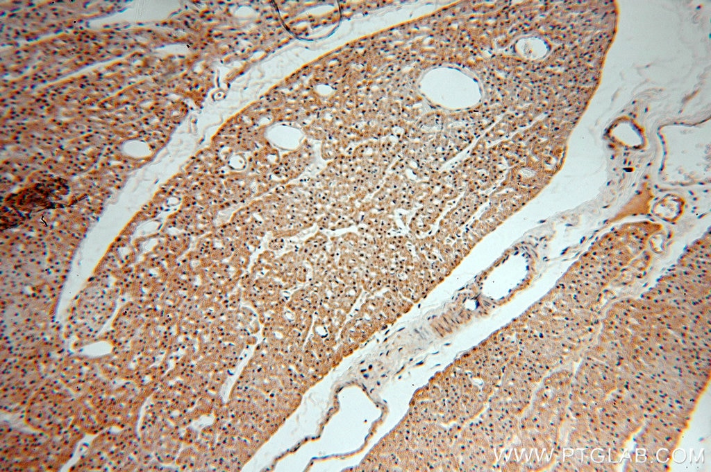 IHC staining of human heart using 13983-1-AP