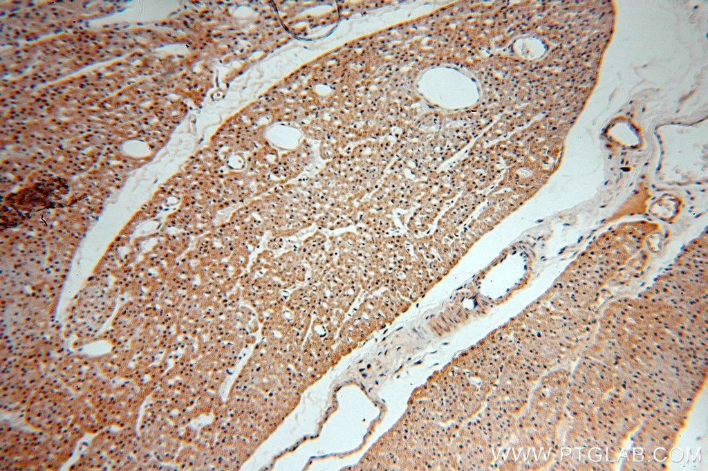 Immunohistochemistry (IHC) staining of human heart tissue using PCAF Polyclonal antibody (13983-1-AP)