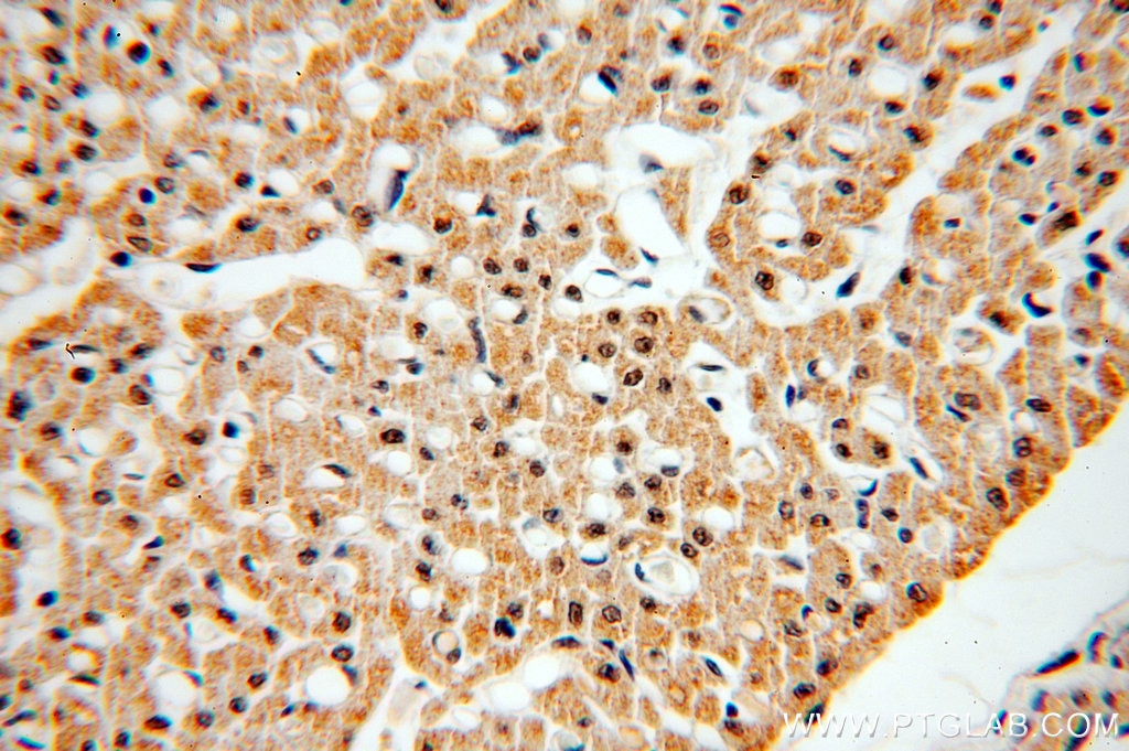 Immunohistochemistry (IHC) staining of human heart tissue using PCAF Polyclonal antibody (13983-1-AP)