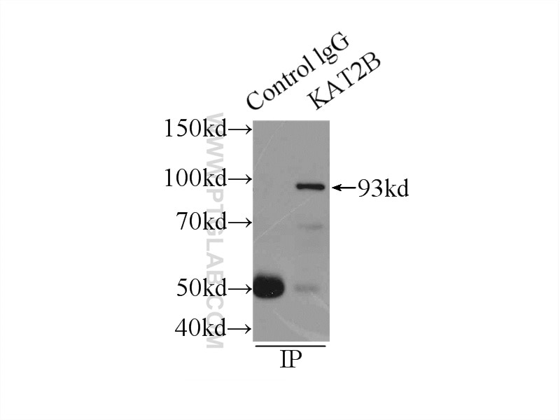 Immunoprecipitation (IP) experiment of HeLa cells using PCAF Polyclonal antibody (13983-1-AP)