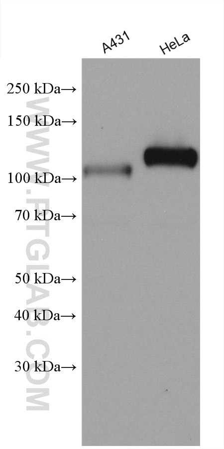 Western Blot (WB) analysis of various lysates using PCAF Polyclonal antibody (28770-1-AP)