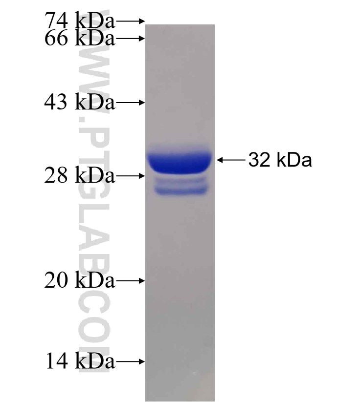 KAT2B fusion protein Ag30238 SDS-PAGE