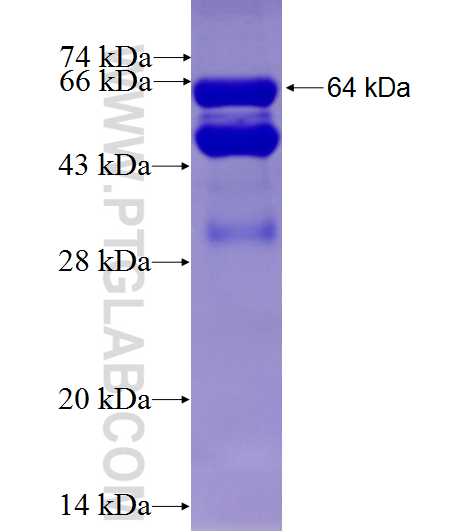 KAT2B fusion protein Ag5028 SDS-PAGE