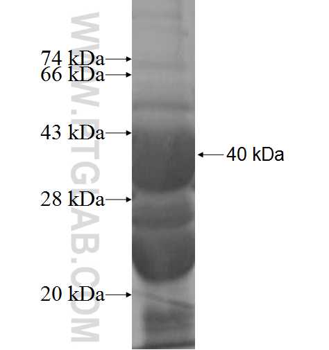 KAT2B fusion protein Ag5787 SDS-PAGE