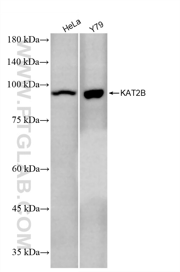 Western Blot (WB) analysis of various lysates using KAT2B/PCAF Recombinant monoclonal antibody (86917-1-RR)