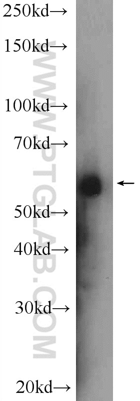 Western Blot (WB) analysis of rat liver tissue using TIP60/KAT5 Polyclonal antibody (10827-1-AP)
