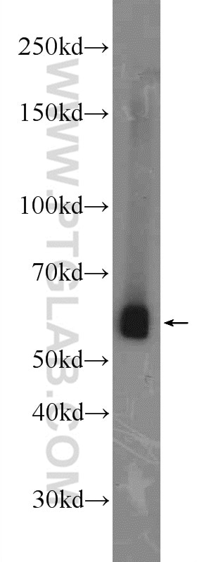 Western Blot (WB) analysis of mouse liver tissue using TIP60/KAT5 Polyclonal antibody (10827-1-AP)