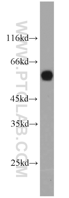 Western Blot (WB) analysis of Jurkat cells using TIP60/KAT5 Polyclonal antibody (10827-1-AP)