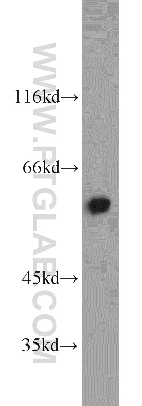 Western Blot (WB) analysis of PC-3 cells using TIP60/KAT5 Polyclonal antibody (10827-1-AP)