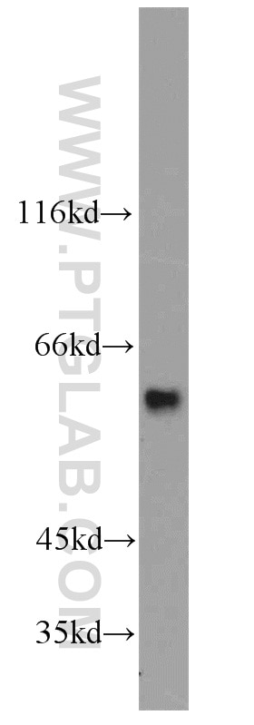 Western Blot (WB) analysis of HeLa cells using TIP60/KAT5 Polyclonal antibody (10827-1-AP)