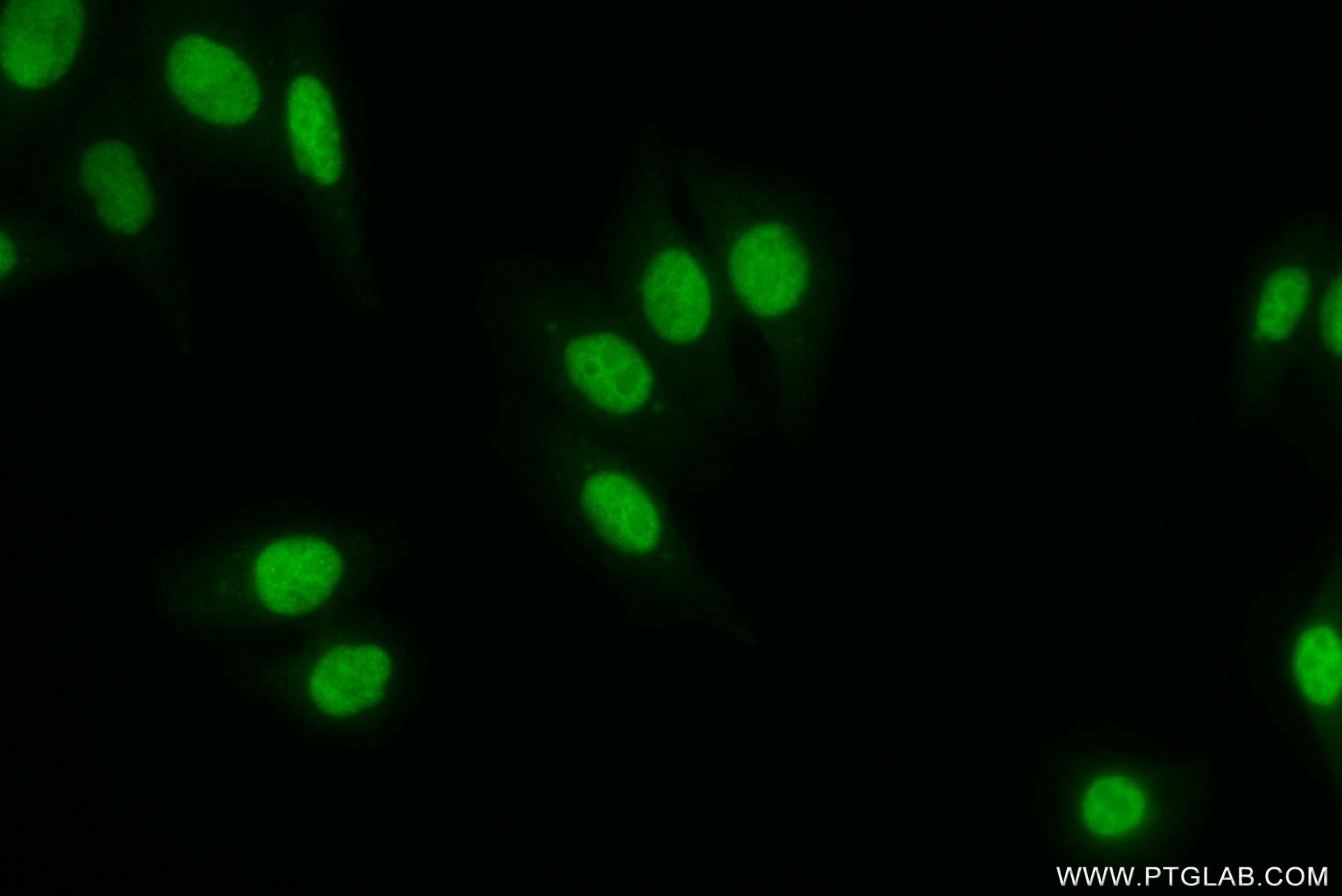 IF Staining of HepG2 using 82937-1-RR