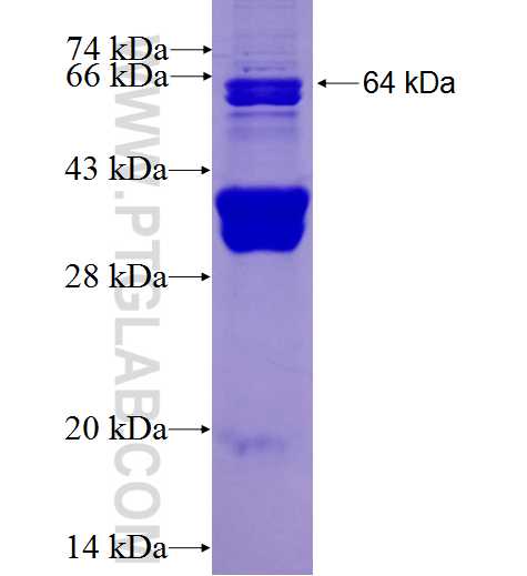 KAT5 fusion protein Ag1261 SDS-PAGE